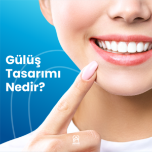 Gülüş Tasarımı